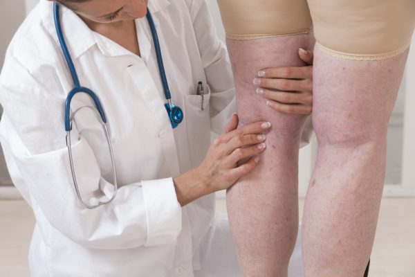 physician providing cosmetic sclerotherapy in utah county ut